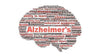 brain alzheimer's 