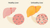 healthy vs unhealthy liver